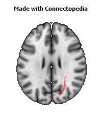 Sagittal_stratum_R080