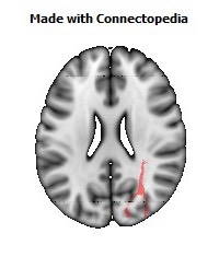 Sagittal_stratum_R084