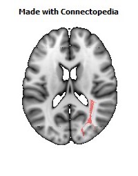 Sagittal_stratum_R090