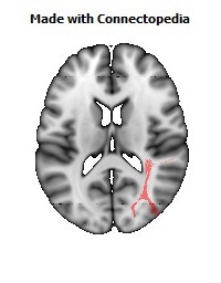 Sagittal_stratum_R092