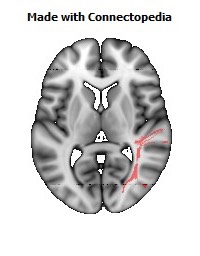 Sagittal_stratum_R100