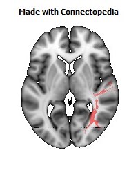 Sagittal_stratum_R104