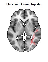 Sagittal_stratum_R106