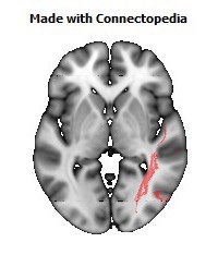 Sagittal_stratum_R108