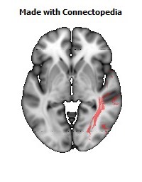 Sagittal_stratum_R110