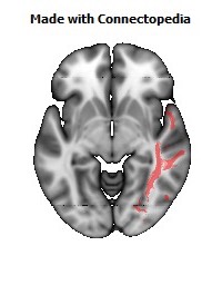 Sagittal_stratum_R114