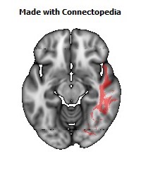 Sagittal_stratum_R120