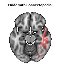 Sagittal_stratum_R122