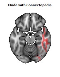 Sagittal_stratum_R124