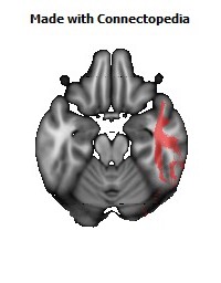 Sagittal_stratum_R128