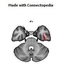 Sagittal_stratum_R140