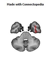 Sagittal_stratum_R144