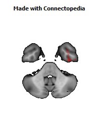 Sagittal_stratum_R148