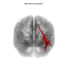 Sagittal Stratum