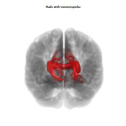 Splenium of Corpus Callosum