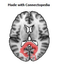 Splenium_of_corpus_callosum094