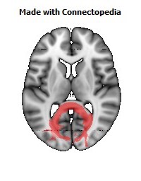 Splenium_of_corpus_callosum098