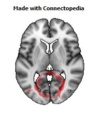 Splenium_of_corpus_callosum102