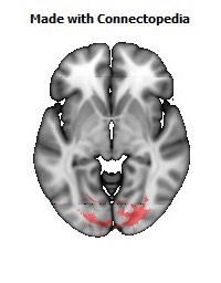 Splenium_of_corpus_callosum112