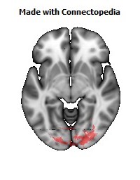 Splenium_of_corpus_callosum114