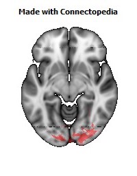 Splenium_of_corpus_callosum116