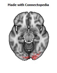 Splenium_of_corpus_callosum120