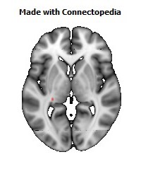 Stria_terminalis_L106