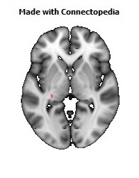 Stria_terminalis_L108