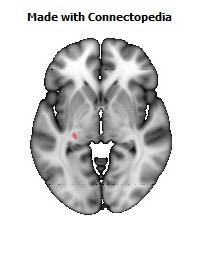 Stria_terminalis_L110