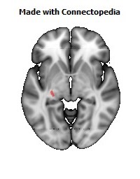 Stria_terminalis_L112