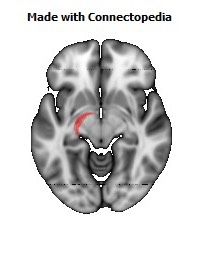 Stria_terminalis_L116