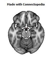 Stria_terminalis_L124