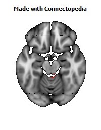 Superior_cerebellar_peduncle_R124