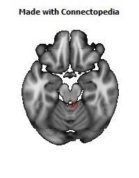 Superior_cerebellar_peduncle_R126