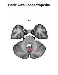 Superior_cerebellar_peduncle_R140