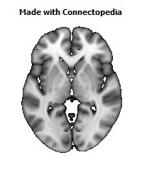 Superior_cerebellar_peduncle_R108