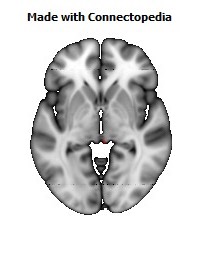 Superior_cerebellar_peduncle_R110