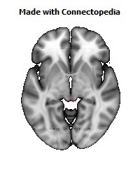 Superior_cerebellar_peduncle_R112