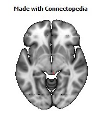 Superior_cerebellar_peduncle_R114