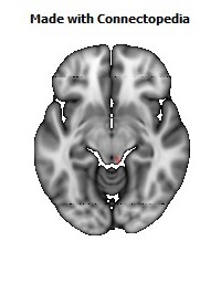 Superior_cerebellar_peduncle_R118