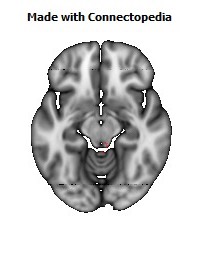 Superior_cerebellar_peduncle_R120