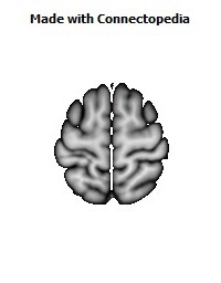 Superior_fronto-occipital_fasciculus_R046