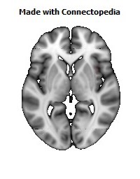 Superior_fronto-occipital_fasciculus_R106