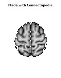 Superior_fronto-occipital_fasciculus_R048