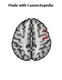 Superior_longitudinal_fasciculus_R060