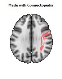 Superior_longitudinal_fasciculus_R078