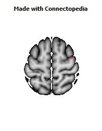 Superior_longitudinal_fasciculus_R048