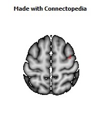 Superior_longitudinal_fasciculus_R050