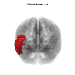 Middle Temporal Gyrus
