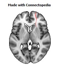 Uncinate_fasciculus_R104